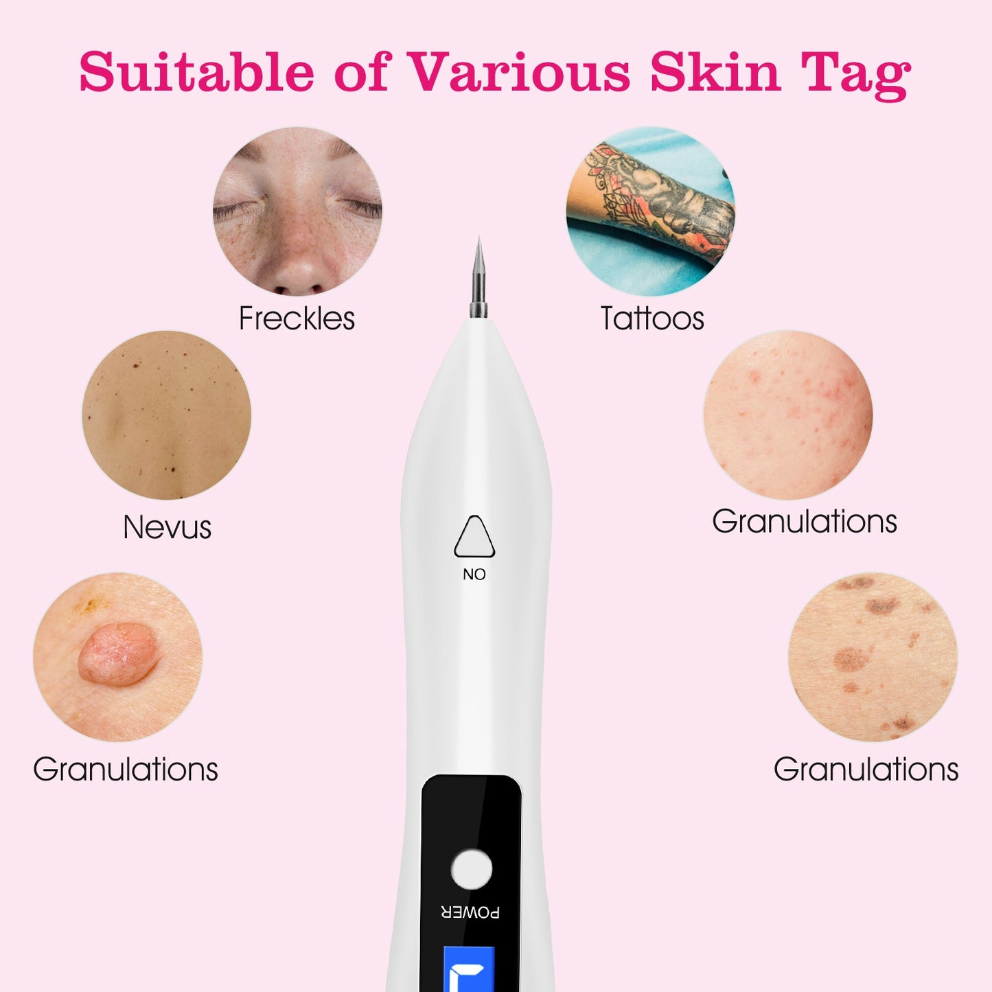 Health & Beauty 2 PCS Skin Tag Repair Kit Portable Beauty Equipment Multi-Level with Home Usage USB Charging LCD Level Adjustable 12 Replaceable Needles